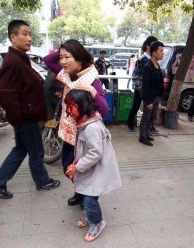 22日、湖南省懐化駅の通り魔事件で負傷した女性