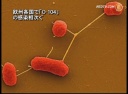 欧州各国で「Ｏ-104」の感染相次ぐ